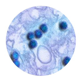Zika Virus (ZIKV) Nucleic Acid Testing (NAT) (2016 –2021)